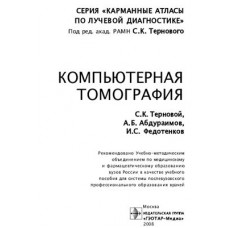 Компьютерная томография