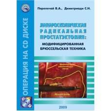 Лапароскопическая радикальная простатэктомия: модифицированная Брюссельская техника