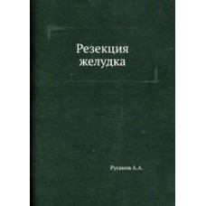 Резекция желудка